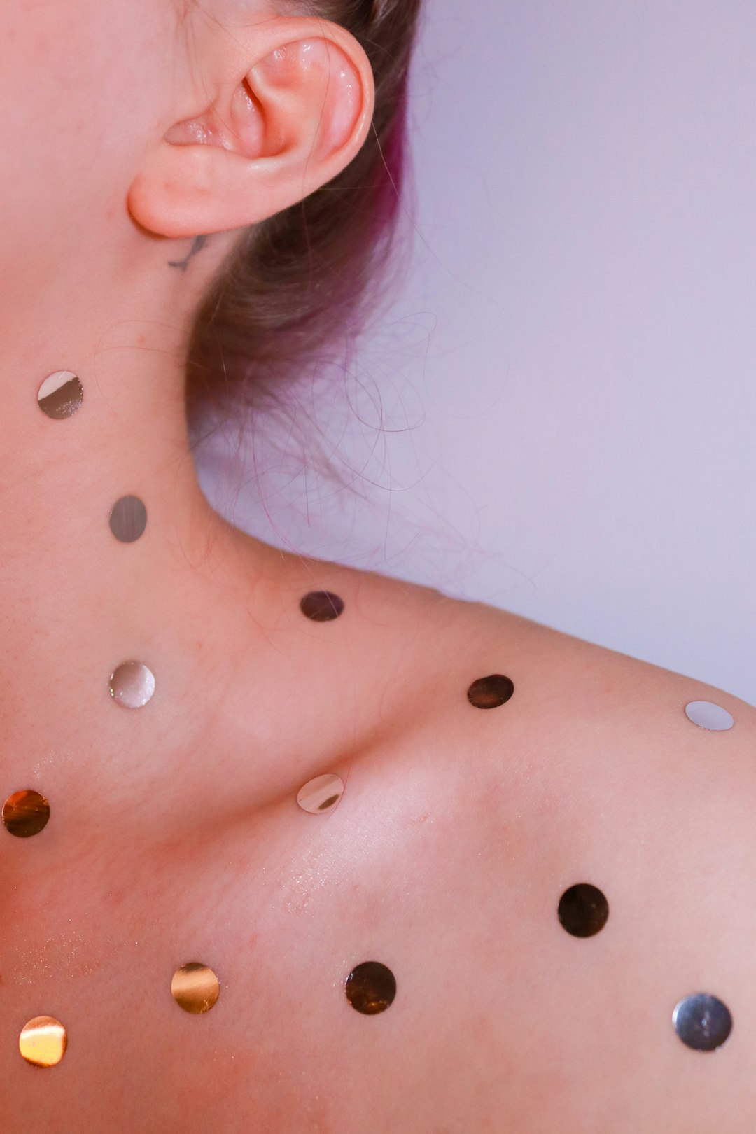 Acupuncture — Pain & Tension Relief